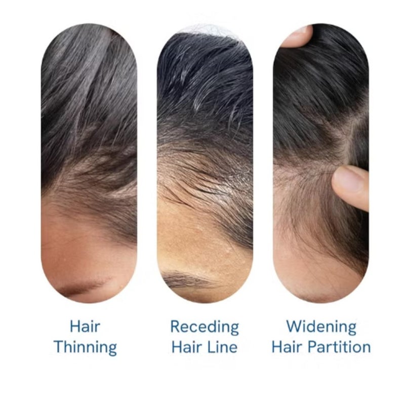 Be Bodywise 3% Redencil & Rosemary Hair Growth Serum (Roll-On) | 1 Pack | 2% Anagen | Thicker, Stronger Hair | Prevents Hair Loss and Stimulates Hair Follicles | For All Hair Types | 25ml - Image 5